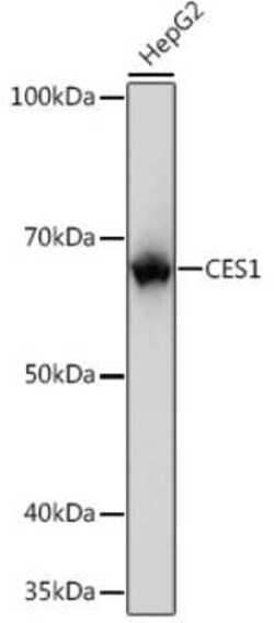 Carboxylesterase 1/CES1 Rabbit anti-Human, Mouse, Rat, Clone: 7C9R6, Novus