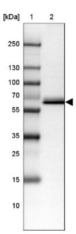 Carboxylesterase 3/CES3/Esterase 31 Antibody, Novus Biologicals 25 &mu;L;