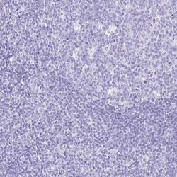 Carboxypeptidase A1/CPA1 Antibody, Novus Biologicals 0.1mL; Unlabeled:Antibodies,