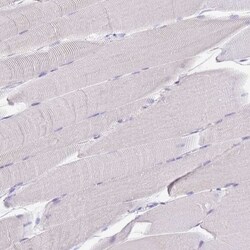 Carboxypeptidase B1/CPB1 Antibody, Novus Biologicals 0.1mL; Unlabeled:Antibodies,