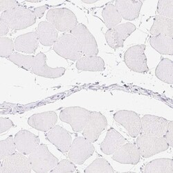 Carboxypeptidase B1/CPB1 Antibody, Novus Biologicals 0.1mL; Unlabeled:Antibodies,