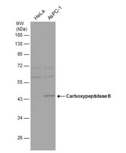 Carboxypeptidase B1/CPB1 Antibody, Novus Biologicals 0.1mg; Unlabeled:Antibodies,