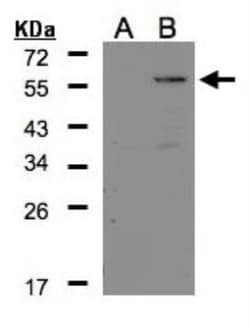 Carboxypeptidase E/CPE Antibody, Novus Biologicals 0.1mL; Unlabeled:Antibodies,