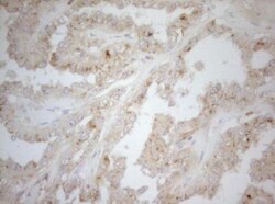 Carboxypeptidase M Antibody (OTI2D11), Novus Biologicals 0.1mL; Unlabeled:Antibodies,