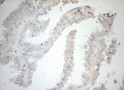 Carboxypeptidase M Antibody (OTI2D11), Novus Biologicals 0.1mL; Unlabeled:Antibodies,