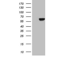 Carboxypeptidase M Antibody (OTI2D11), Novus Biologicals 0.1mL; Unlabeled:Antibodies,