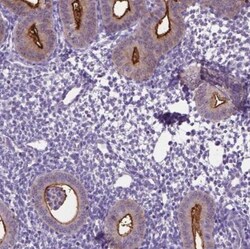 Carboxypeptidase M Antibody, Novus Biologicals:Antibodies:Primary Antibodies