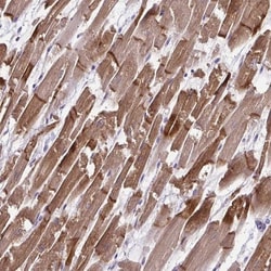Cardiac Leiomodin Antibody, Novus Biologicals:Antibodies:Primary Antibodies