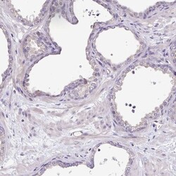 Cardiac Leiomodin Antibody, Novus Biologicals:Antibodies:Primary Antibodies