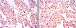 Carm1 Antibody (3H2), Novus Biologicals:Antibodies:Primary Antibodies