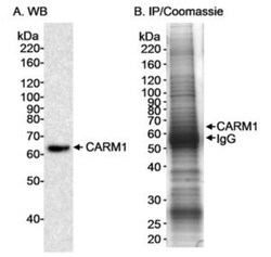 Carm1 Antibody, Novus Biologicals 0.1mL; Unlabeled:Antibodies, Polyclonal