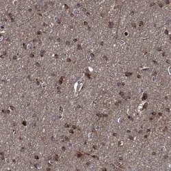 Carnosine Dipeptidase 1/CNDP1 Rabbit anti-Human, Polyclonal, Novus Biologicals 25 &mu;g | Buy Online | Bio-Techne | Fisher Scientific