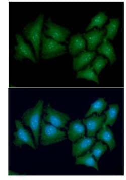 Casein Kinase 1 alpha Antibody (2E2) - BSA Free, Novus Biologicals 0.1mL;