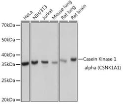 Casein Kinase 1 alpha Rabbit anti-Human, Mouse, Rat, Clone: 9O4L9, Novus Biologicals 100 &mu;g | Buy Online | Novus Biologicals | Fisher Scientific
