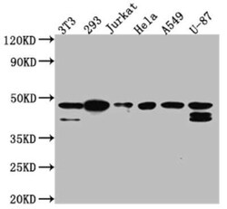 Casein Kinase 2 alpha Antibody (2B6), Novus Biologicals 100 &mu;g; Unconjugated:Antibodies,