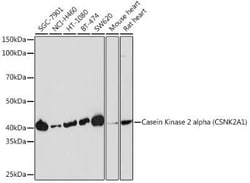Casein Kinase 2 alpha Rabbit anti-Human, Mouse, Rat, Clone: 2P3M7, Novus Biologicals 100 &mu;g | Buy Online | Novus Biologicals | Fisher Scientific