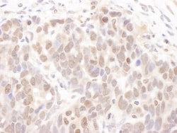 Casein Kinase 2 alpha Antibody, Novus Biologicals 0.1mg; Unlabeled:Antibodies,