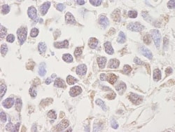 Casein Kinase 2 alpha Antibody, Novus Biologicals 0.1mg; Unlabeled:Antibodies,