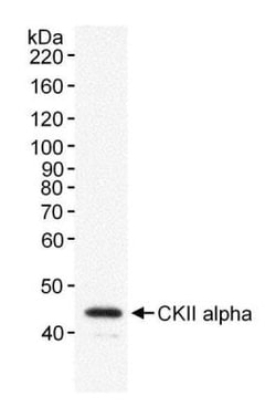 Casein Kinase 2 alpha Antibody, Novus Biologicals 0.1mg; Unlabeled:Antibodies,