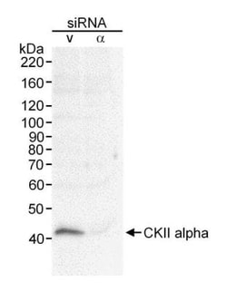 Casein Kinase 2 alpha Antibody, Novus Biologicals 100 &mu;L | Buy Online | Novus Biologicals | Fisher Scientific