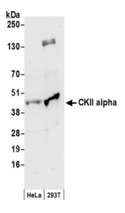 Casein Kinase 2 alpha Antibody, Novus Biologicals 100 &mu;L | Buy Online | Novus Biologicals | Fisher Scientific