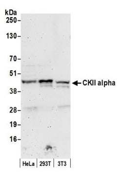Casein Kinase 2 alpha Antibody, Novus Biologicals 100 &mu;L | Buy Online | Novus Biologicals | Fisher Scientific