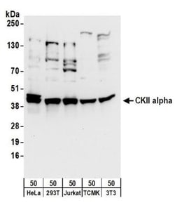 Casein Kinase 2 alpha Antibody, Novus Biologicals 0.1mg; Unlabeled:Antibodies,