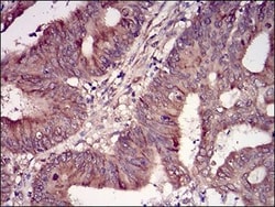 Casein Kinase 2 beta Antibody (2F12F3) - BSA Free, Novus Biologicals 0.1mg;