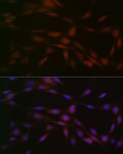 Casein Kinase 2 beta Rabbit anti-Human, Mouse, Rat, Clone: 9T5J10, Novus