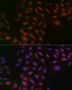 Casein Kinase 2 beta Rabbit anti-Human, Mouse, Rat, Clone: 9T5J10, Novus