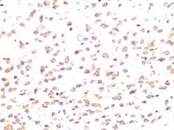 Casein Kinase 2 beta Rabbit anti-Human, Mouse, Rat, Clone: 9T5J10, Novus
