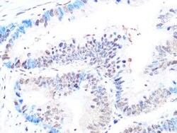 Casein Kinase 2 beta Rabbit anti-Human, Mouse, Rat, Clone: 9T5J10, Novus