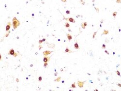 Casein Kinase 2 beta Rabbit anti-Human, Mouse, Rat, Clone: 9T5J10, Novus