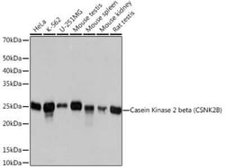 Casein Kinase 2 beta Rabbit anti-Human, Mouse, Rat, Clone: 9T5J10, Novus