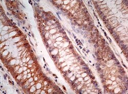 Caspase-1 Antibody (14F468) - Azide and BSA Free, Novus Biologicals 0.1mg;