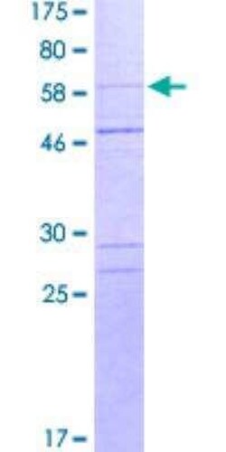 Novus Biologicals Recombinant Human Caspase-1 GST (N-Term) Protein 2 &mu;g | Buy Online | Novus Biologicals&trade; | Fisher Scientific