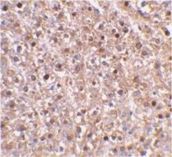 Caspase-12 Antibody - BSA Free, Novus Biologicals 0.025mg:Antibodies, Polyclonal