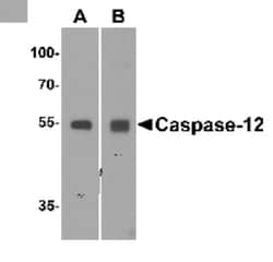 Caspase-12 Antibody - BSA Free, Novus Biologicals 0.025mg:Antibodies, Polyclonal