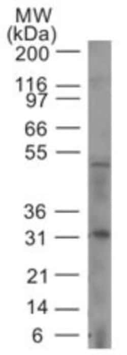 Caspase-14 Antibody (70A1426), Novus Biologicals 0.2mL; Unlabeled:Antibodies,