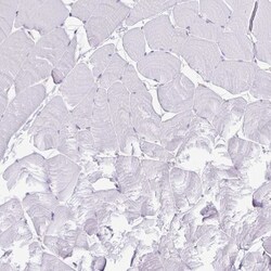 Caspase-14 Antibody, Novus Biologicals:Antibodies:Primary Antibodies
