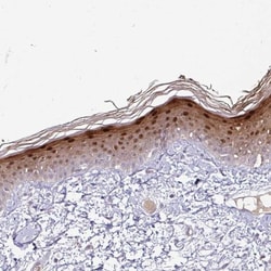Caspase-14 Antibody, Novus Biologicals:Antibodies:Primary Antibodies