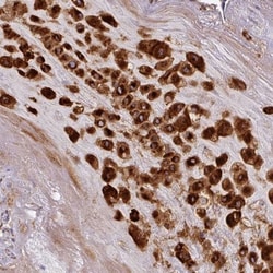 Caspase-2 Antibody, Novus Biologicals 0.1mL; Unlabeled:Antibodies, Polyclonal