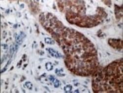 Caspase-3 Antibody - (Pro and Active), Novus Biologicals 0.025mL; Unlabeled:Antibodies,