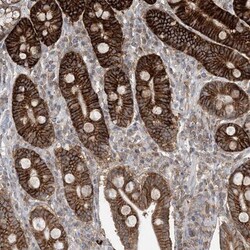 Caspase-4 Antibody, Novus Biologicals 0.1mL; Unlabeled:Antibodies, Polyclonal