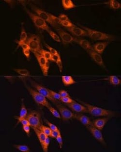 Caspase-6 Rabbit anti-Human, Mouse, Clone: 2W4G2, Novus Biologicals 100 &mu;g | Buy Online | Novus Biologicals | Fisher Scientific