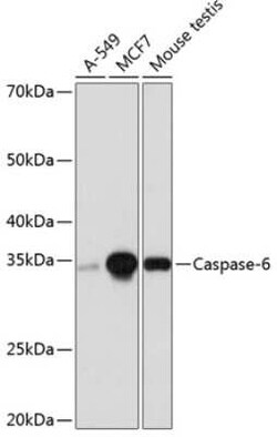 Caspase-6 Rabbit anti-Human, Mouse, Clone: 2W4G2, Novus Biologicals 100 &mu;g | Buy Online | Novus Biologicals | Fisher Scientific