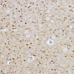 Caspase-6 Rabbit anti-Human, Mouse, Rat, Clone: 6D7S2, Novus Biologicals