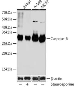 Caspase-6 Rabbit anti-Human, Mouse, Rat, Clone: 6D7S2, Novus Biologicals