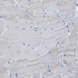 Caspase-6 Antibody, Novus Biologicals:Antibodies:Primary Antibodies