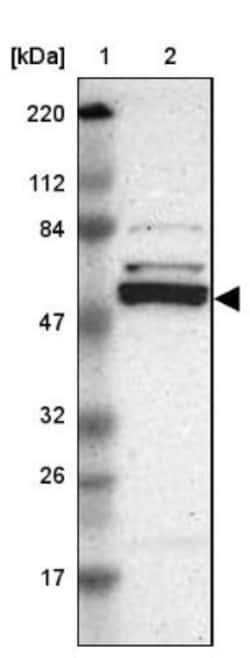 Caspase-8 Antibody, Novus Biologicals:Antibodies:Primary Antibodies